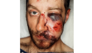 Injured Tucson police officer. Credit Tucson Police Officers Association